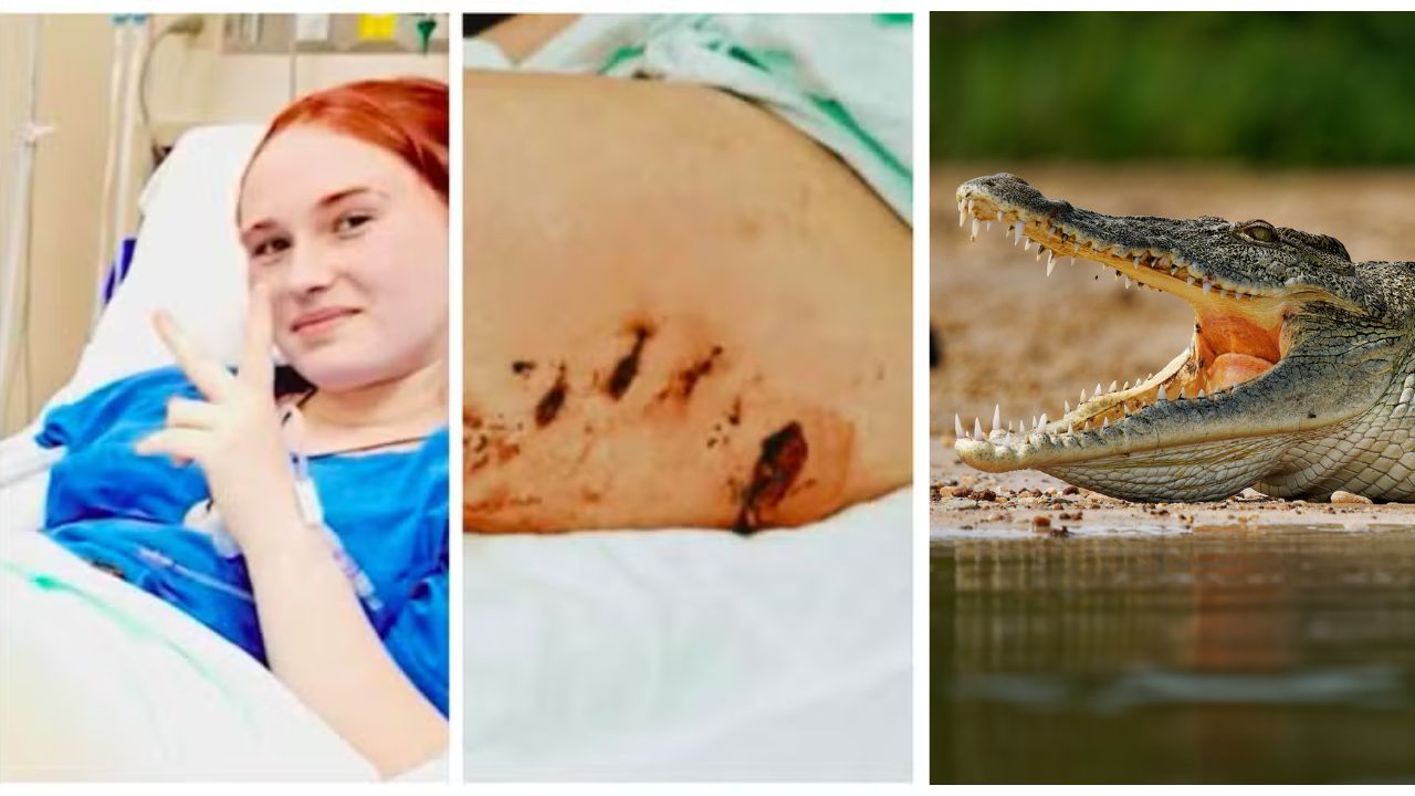 Adolescente sobrevive a ataque de crocodilo após enfrentar animal com socos