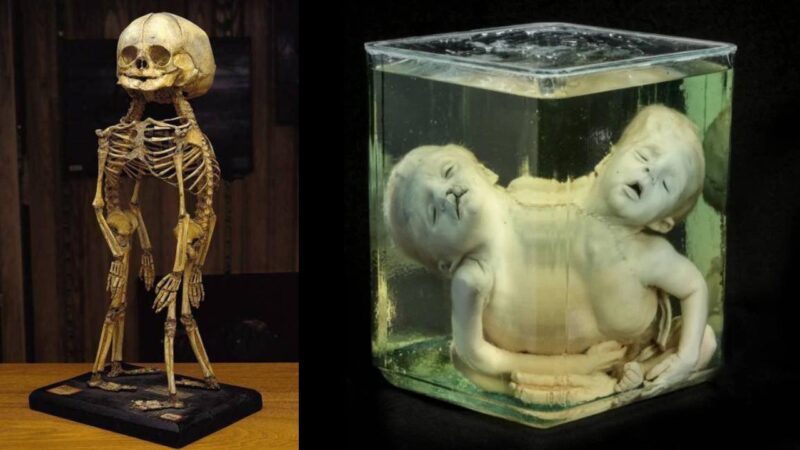 O museu da Filadélfia que reúne as mais estranhas peculiaridades da história da medicina