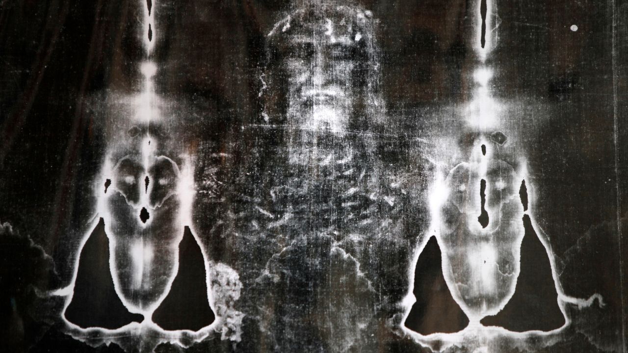 imagem raio-x sudário