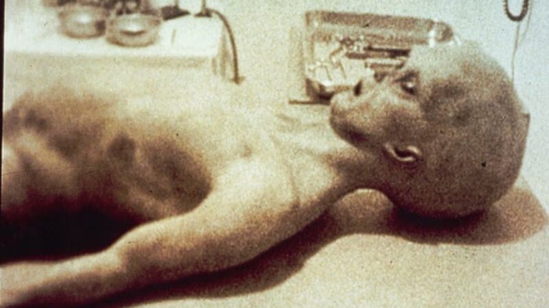 A falsa ‘autópsia’ alienígena que chocou o mundo na década de 1990