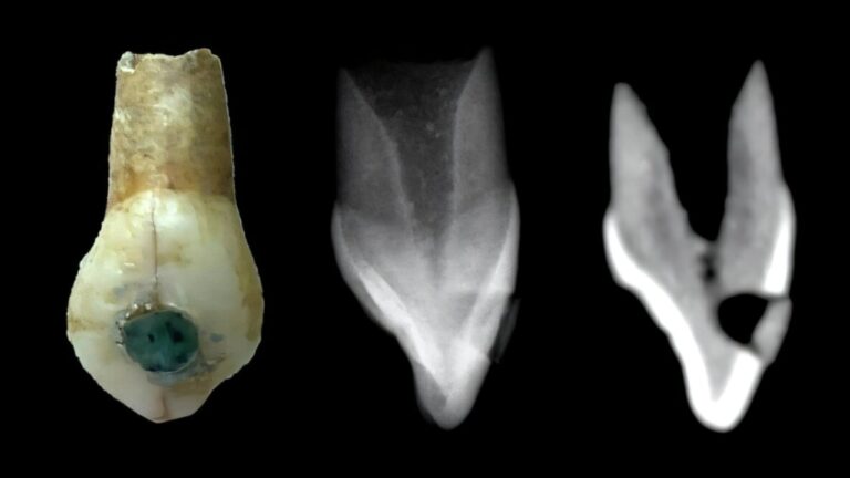 Estudo descobre que crianças maias também receberam incrustações nos dentes