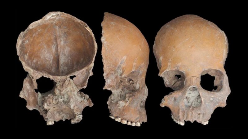 Humanos realizavam modificações ósseas na China pré-histórica