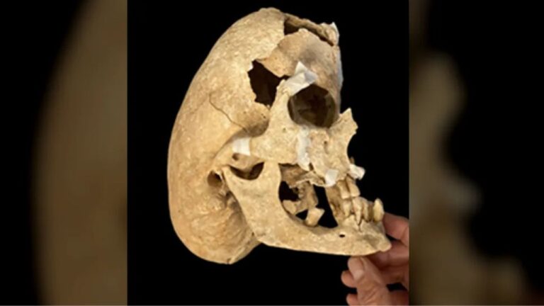 Crânio de cavaleiro medieval com condição genética rara é encontrado na Espanha
