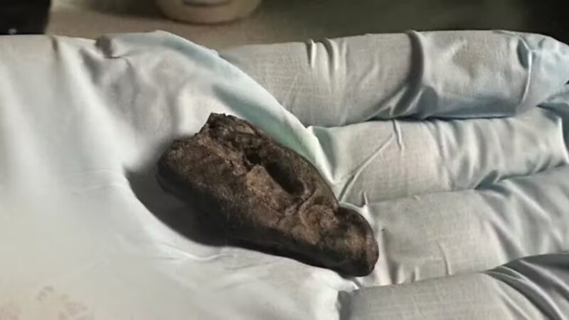 Adolescente da Idade da Pedra mascou ‘chiclete’ pré-histórico há 10.500 anos