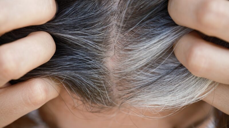 Cabelos grisalhos podem ser uma proteção contra o câncer, sugere estudo