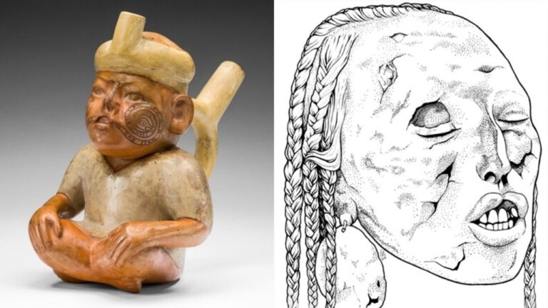 Estudo de cabeça-troféu do Peru revela sobrevivência de indivíduo com deficiência congênita