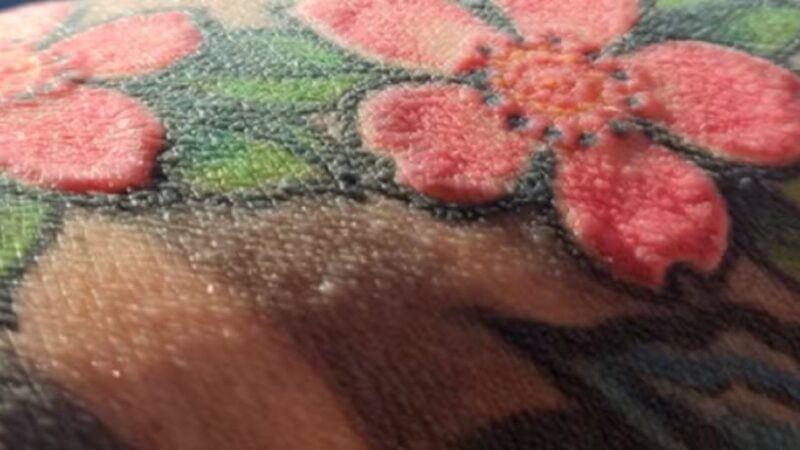 Homem perde cabelos e capacidade de suar após fazer tatuagem na Polônia