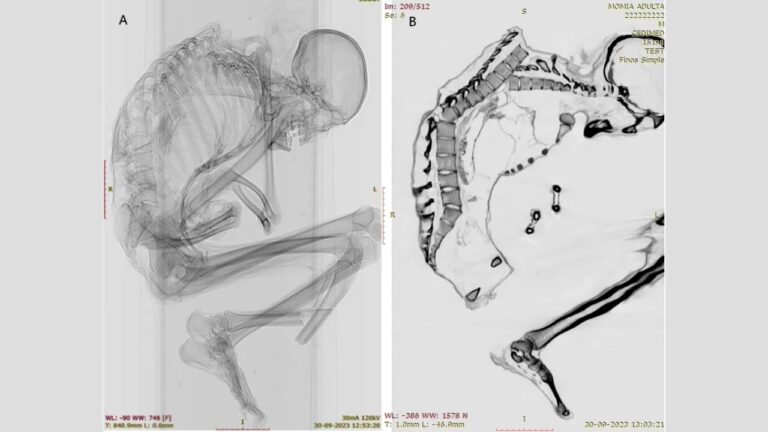 Múmia encontrada no Atacama morreu em acidente de mineração há mais de mil anos