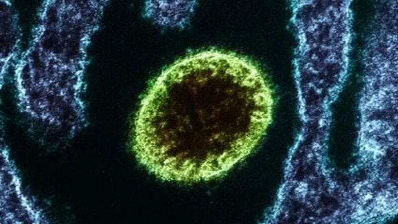 Tudo que sabemos sobre o vírus Nipah até agora
