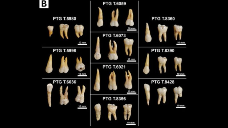 Dentes Idade do Ferro