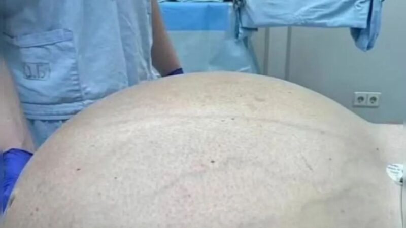 tumor