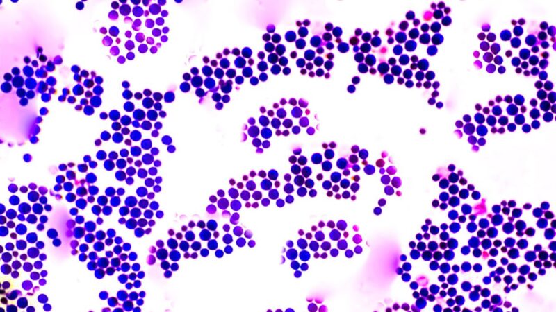 Fungo que se torna mais letal quando associado à tuberculose preocupa OMS