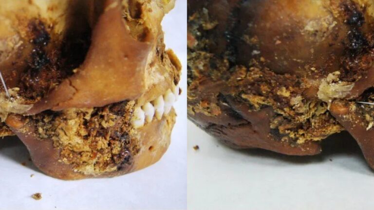 ‘Prótese primitiva’ é descoberta em mandíbula de múmia de 2.500 anos da Sibéria