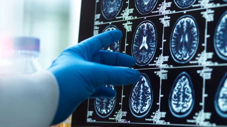 Estudo revela defesa natural do cérebro contra o Alzheimer