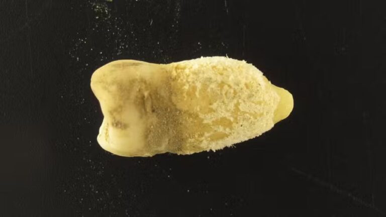 Bactéria da escarlatina é descoberta em múmia pré-colombiana