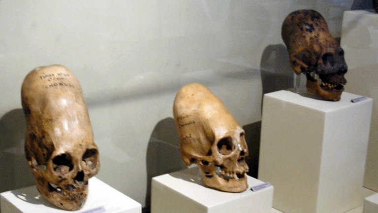Nova análise de DNA reacende mistério sobre múmias ‘cabeça de cone’ encontradas no Peru