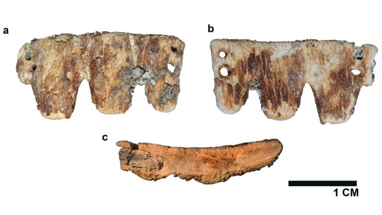 Ponte dentária rara do século 19 é descoberta em Portugal