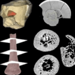 Restos de bebê neandertal revelam crescimento semelhante ao dos humanos modernos