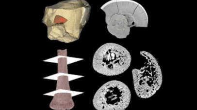Restos de bebê neandertal revelam crescimento semelhante ao dos humanos modernos