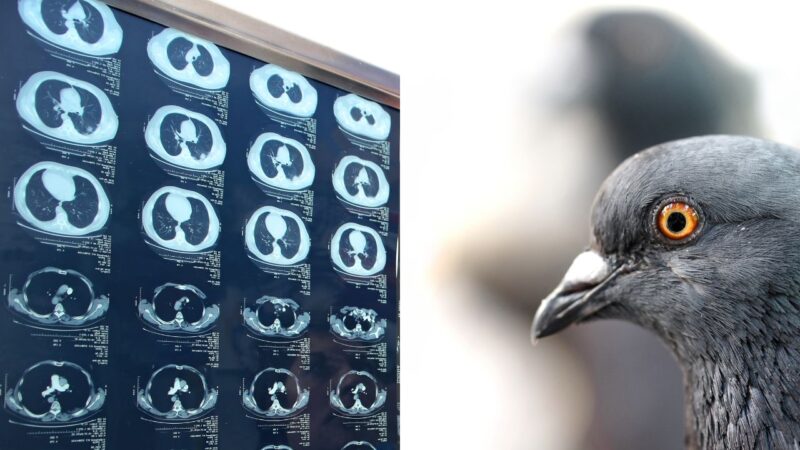 Foto de radiografia e de pombo para elucidar como pombos podem ser usados para detectar câncer