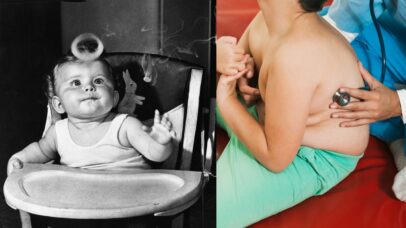 Poluição pode provocar obesidade infantil, diz estudo