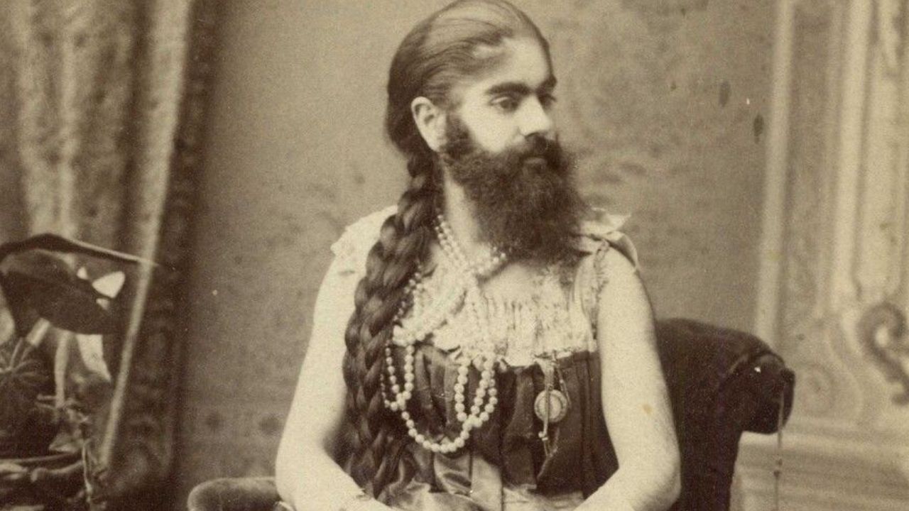 Atração de circo nos primeiros meses de vida: A cruel saga de Annie Jones, a Mulher Barbada