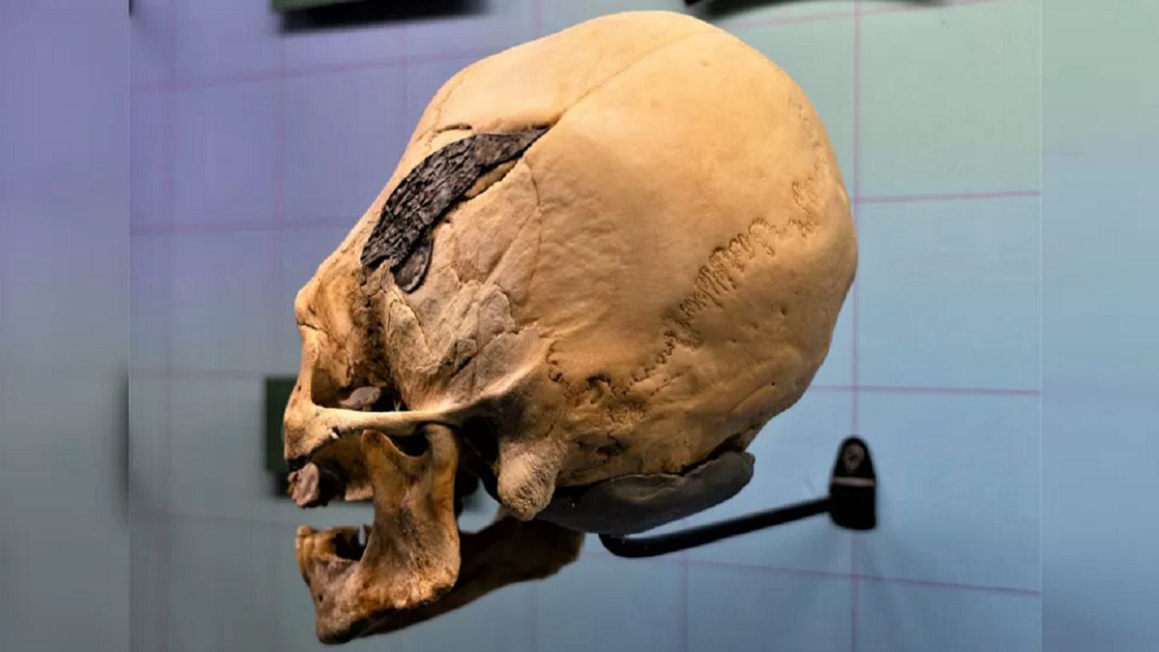 O que explica os crânios alongados já identificados por pesquisadores?