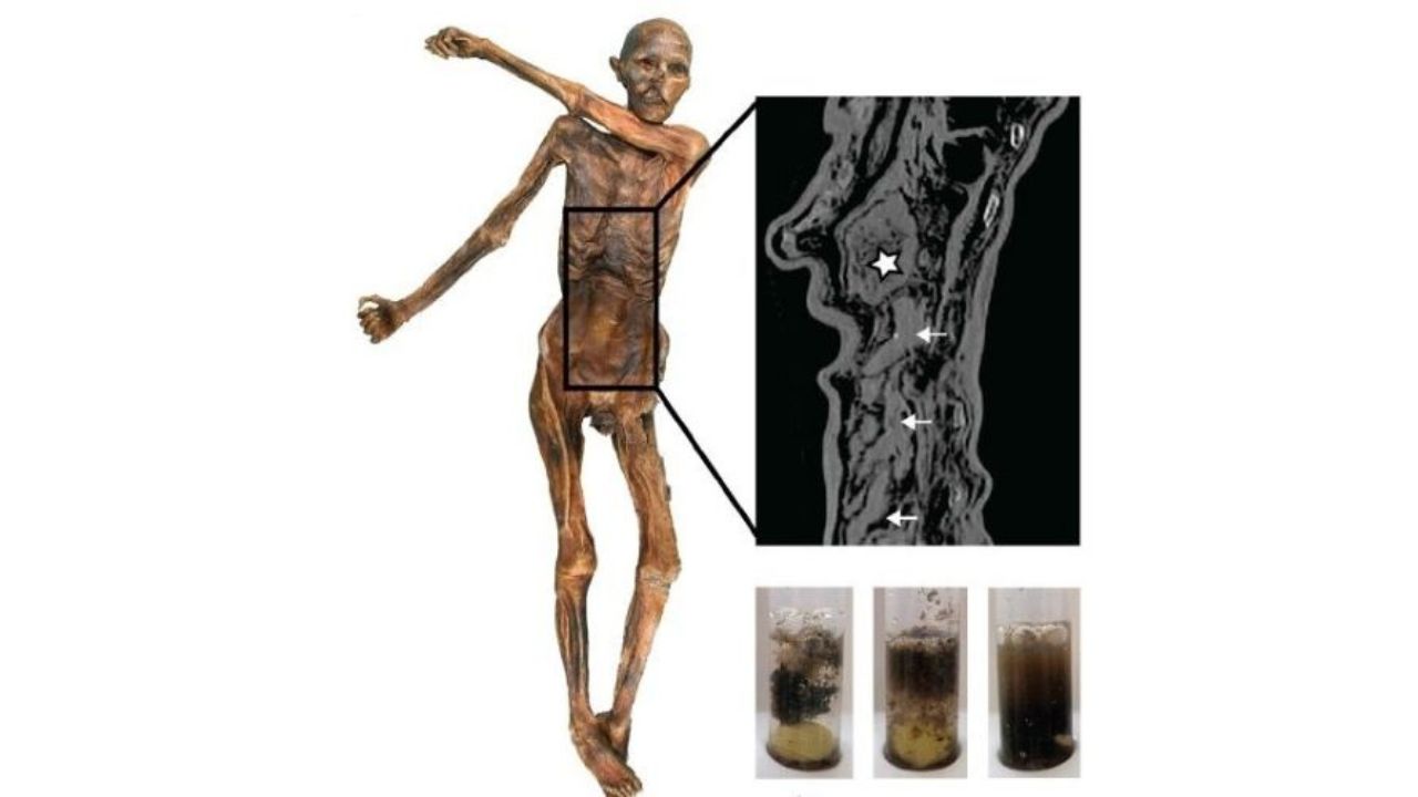 Múmia de gelo: A curiosa alimentação de Ötzi que viveu há 5,3 mil anos