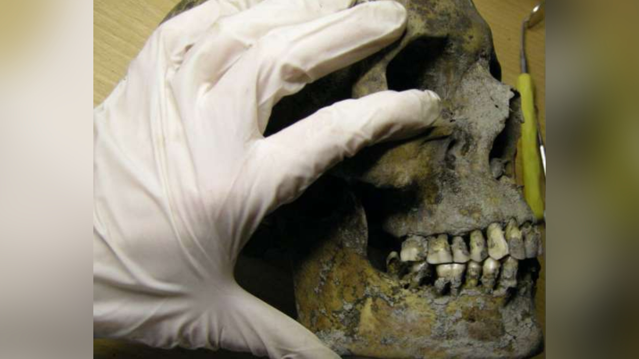Vikings da Suécia sofriam com cáries dentárias, aponta estudo