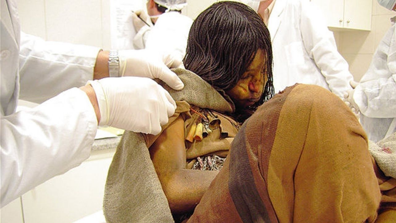 A múmia inca que teve infecção no pulmão no momento da morte