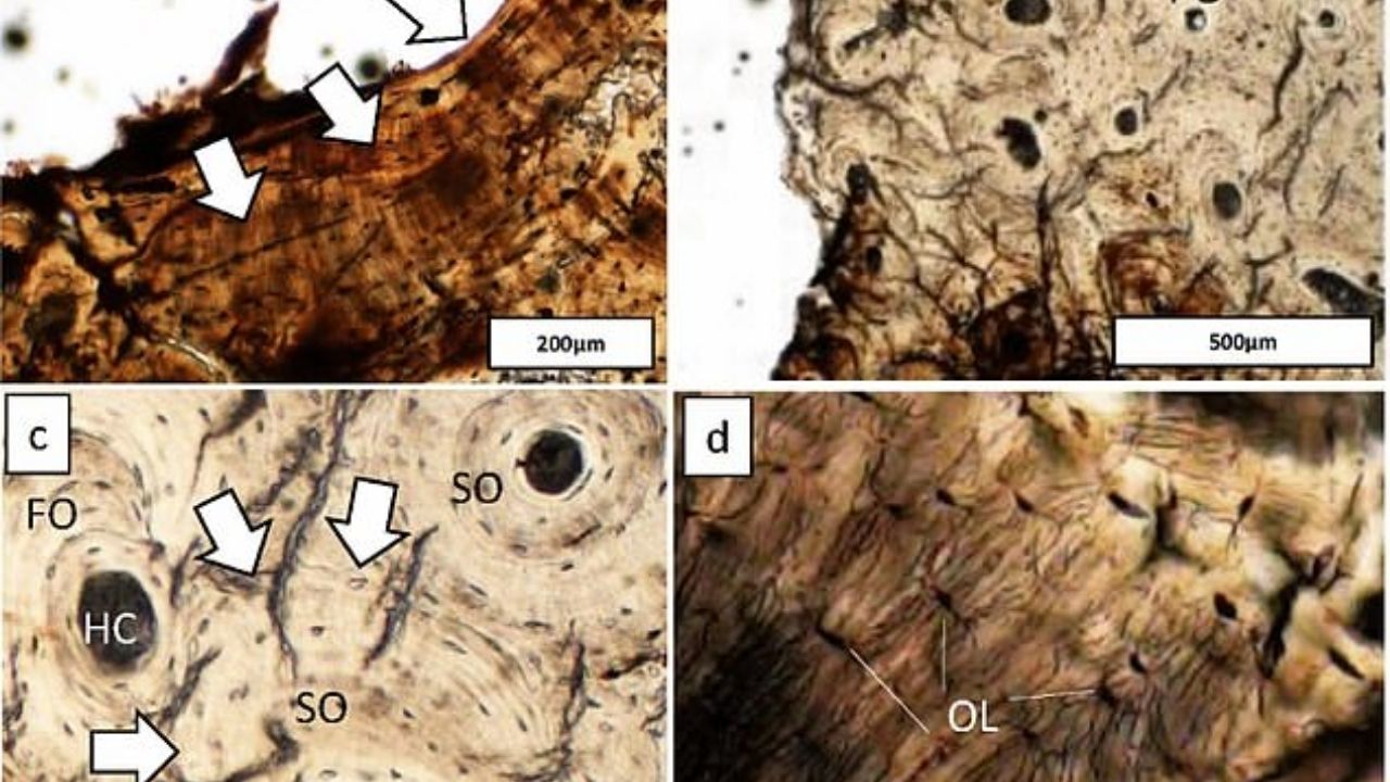 Estudo indica que malária afetava seres humanos milhares de anos antes do que se acreditava
