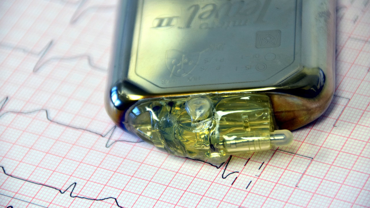 A história do marca-passo: Um aparelho que transformou o mundo da cardiologia