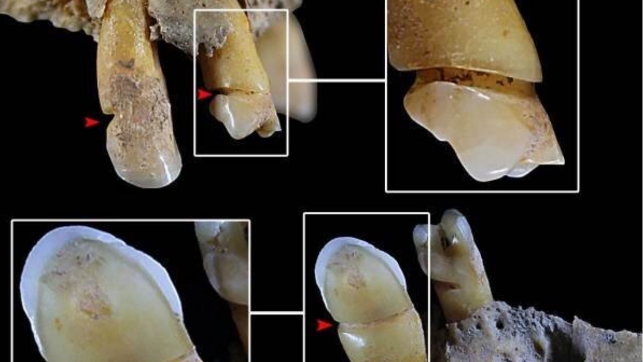 Mulheres de cultura da Idade do Bronze usavam dentes como ferramentas