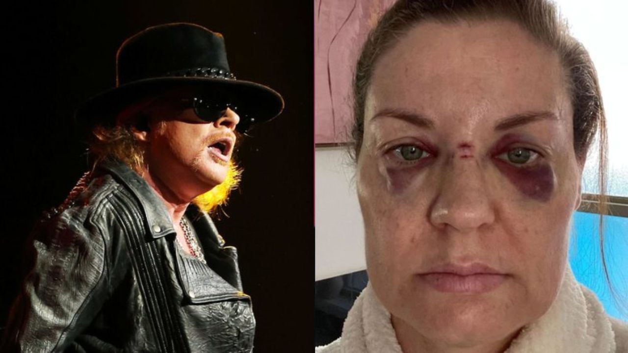 Axl Rose anuncia fim de tradição de 30 anos após fã sair de show machucada