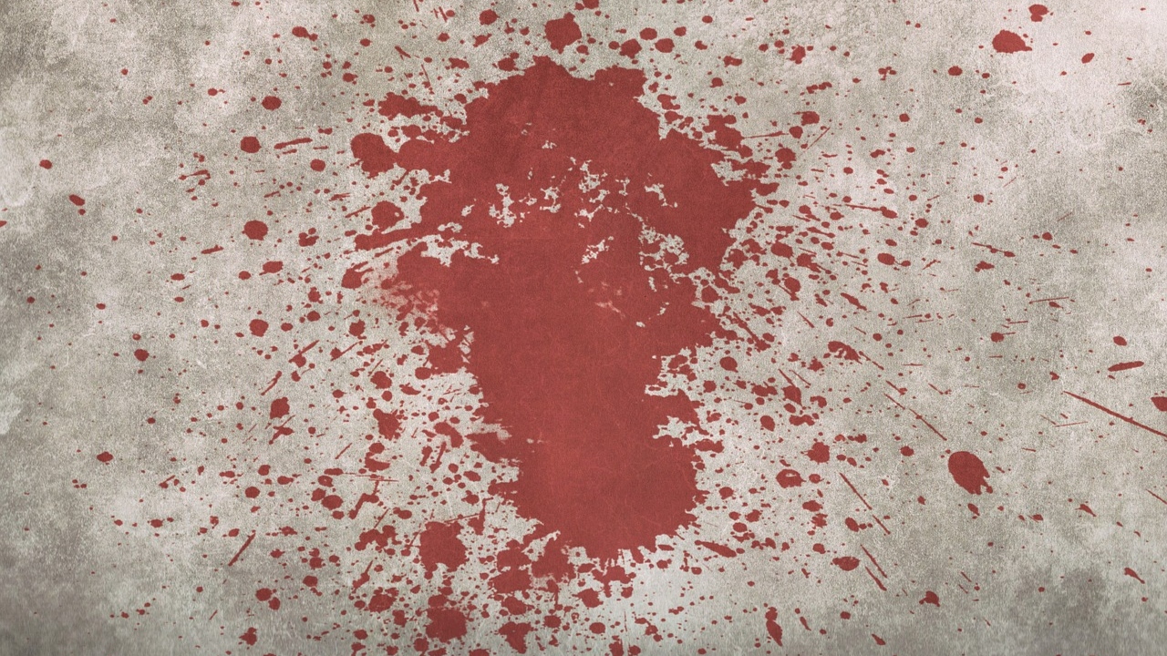 Nos EUA, mulher acorda de madrugada com sangue pingando do teto