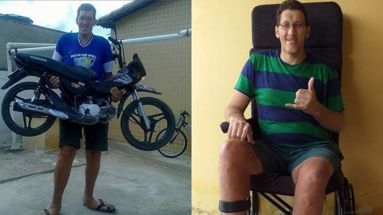 Homem mais alto do Brasil passará por cirurgia para amputar a perna