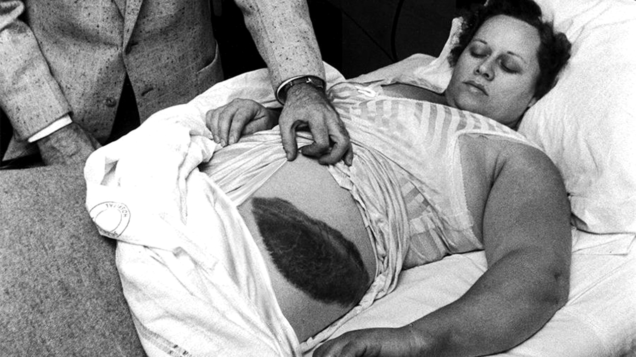 Ann Hodges: A única sobrevivente do impacto de um meteorito na História