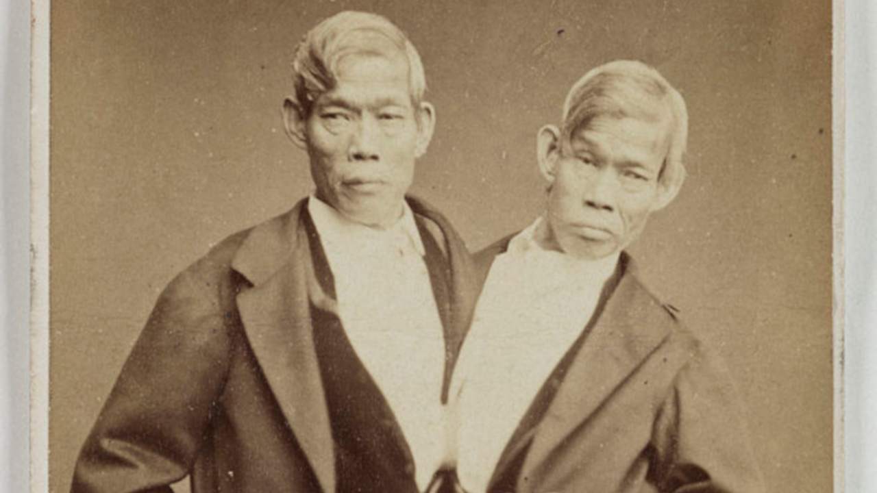 Artistas e renegados: 5 irmãos siameses e suas histórias curiosas
