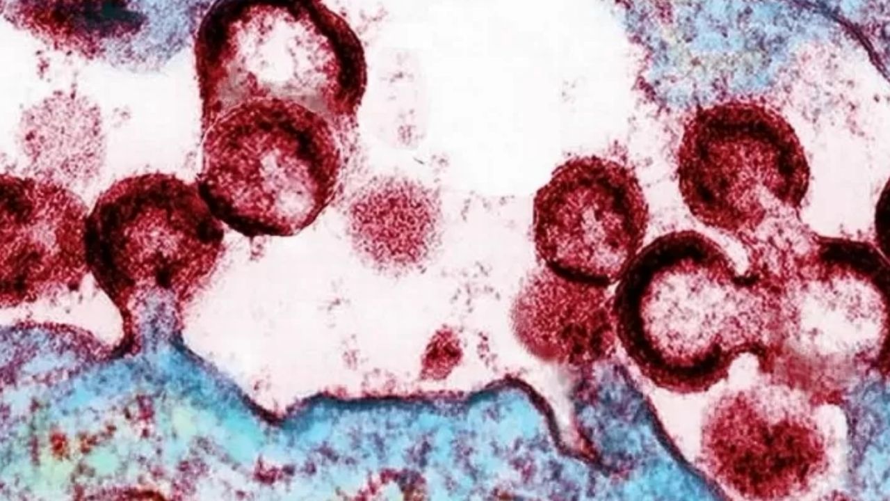 Variante mais transmissível do vírus HIV é descoberta