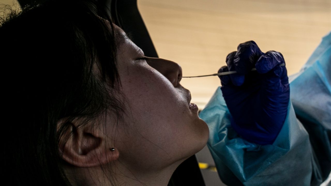 Quais são as diferenças entre os sintomas da gripe e Covid-19?