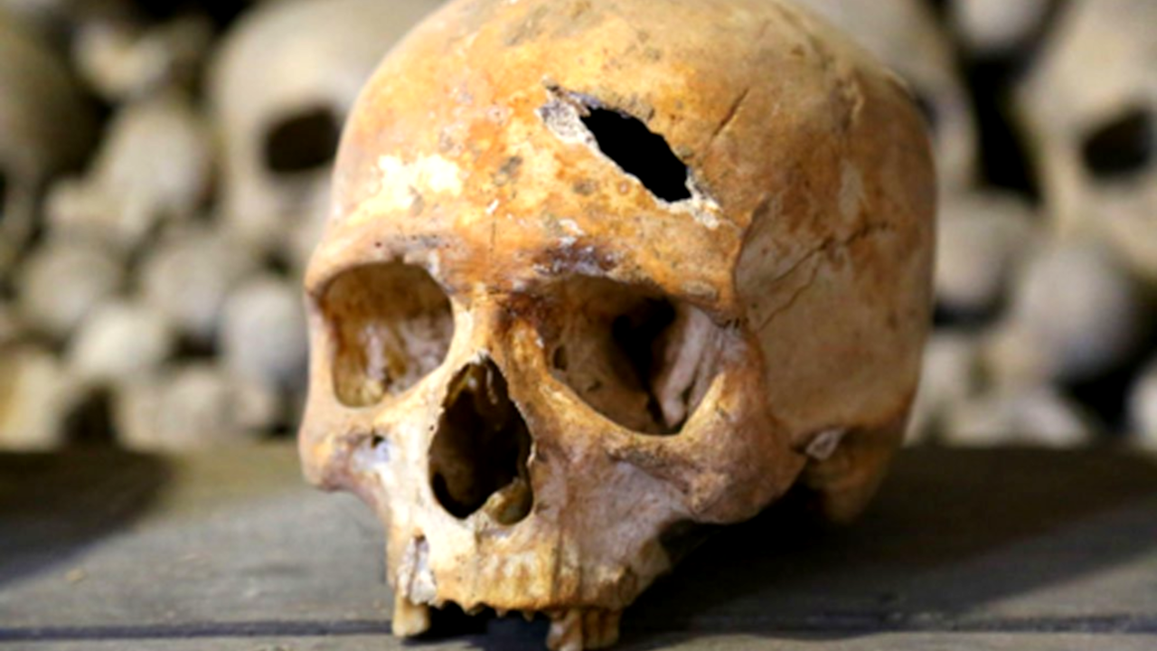 Crânio medieval, encontrado no Reino Unido, revela morte violenta