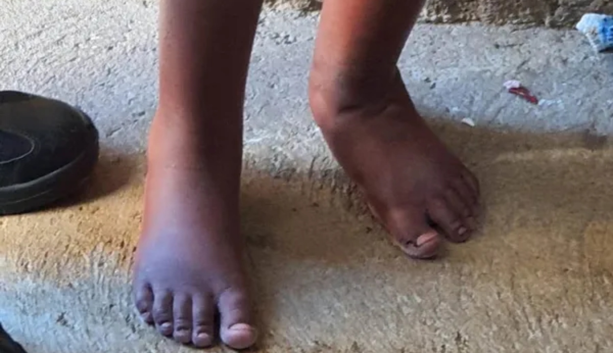 Menino que foi encontrado acorrentado em barril espera adoção após 2 anos
