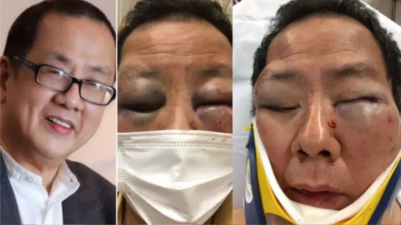 Danny Yu Chang, o idoso asiático vítima de um espancamento em San Francisco