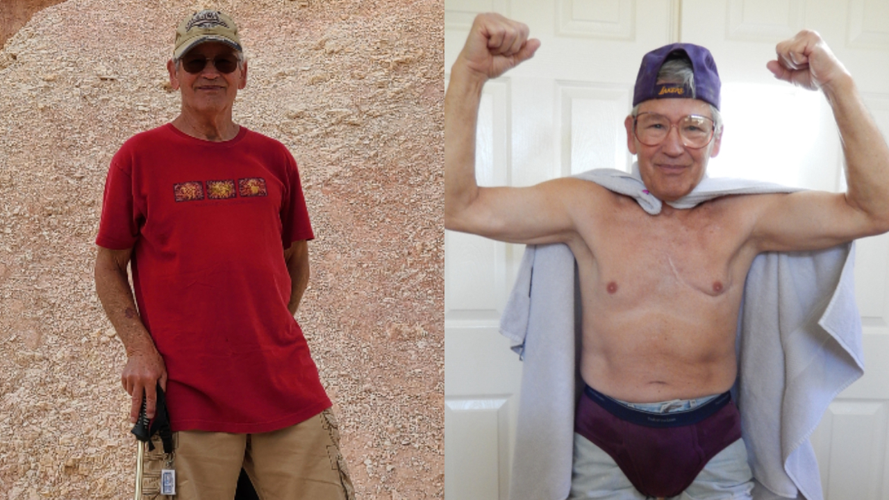 Americano de 82 anos bate recorde 71 anos após cirurgia cardíaca