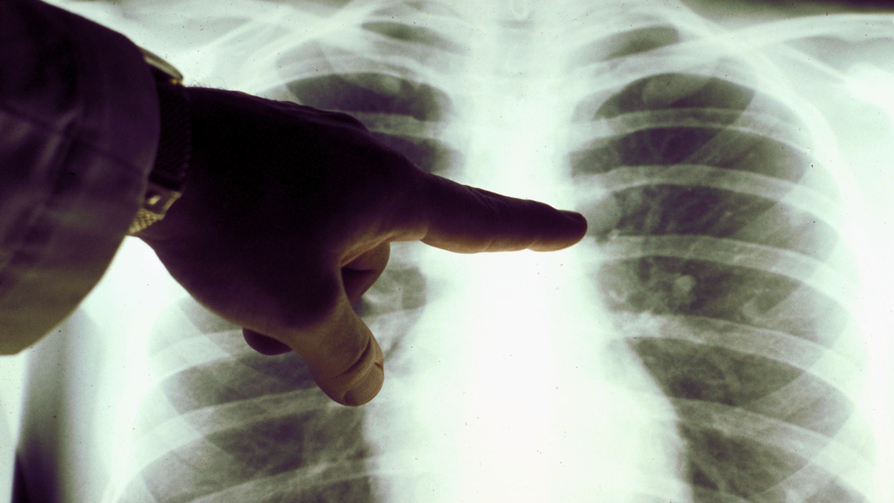 Medicina precária: Como fazíamos antes do Raio-X?
