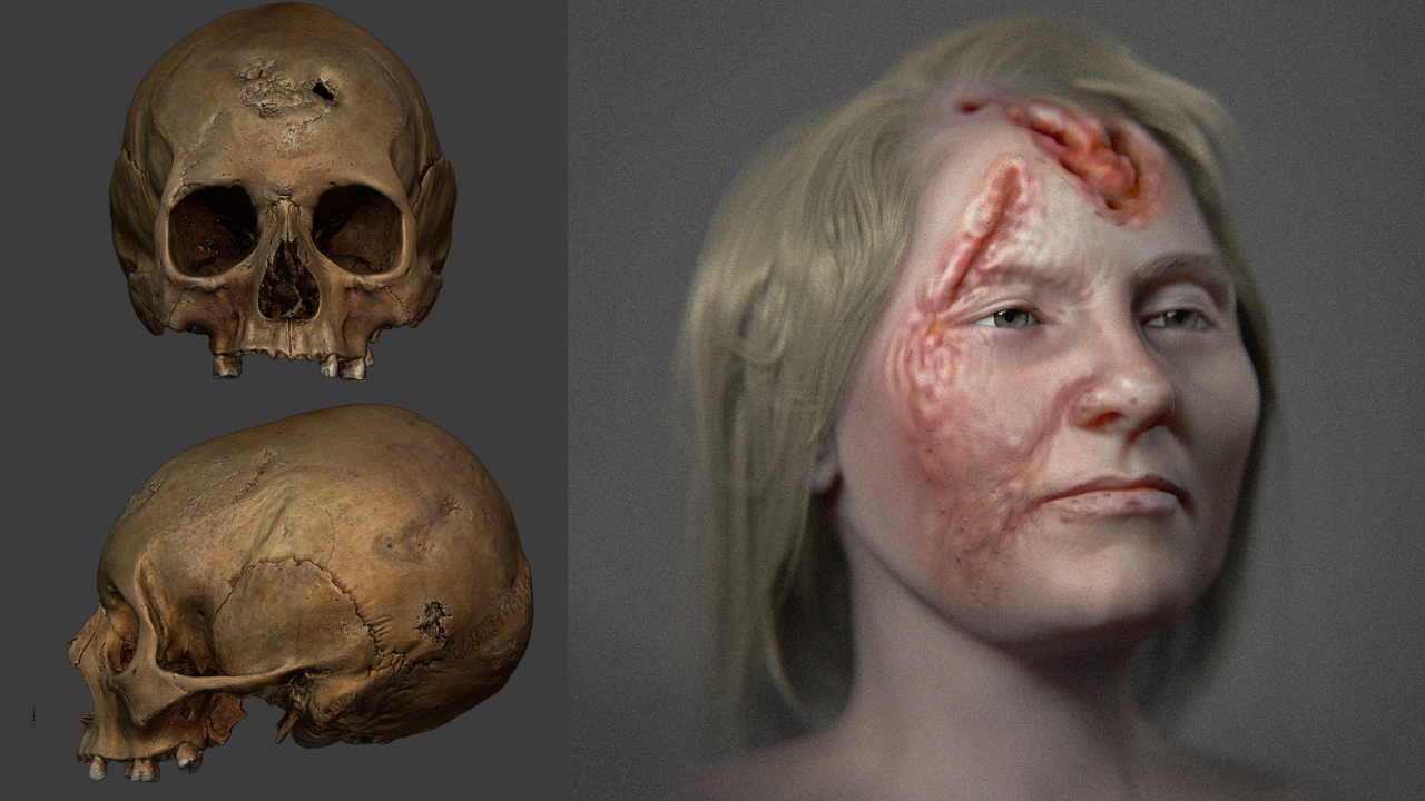Rosto de mulher com sífilis do século 16 é reconstruído por artista brasileiro