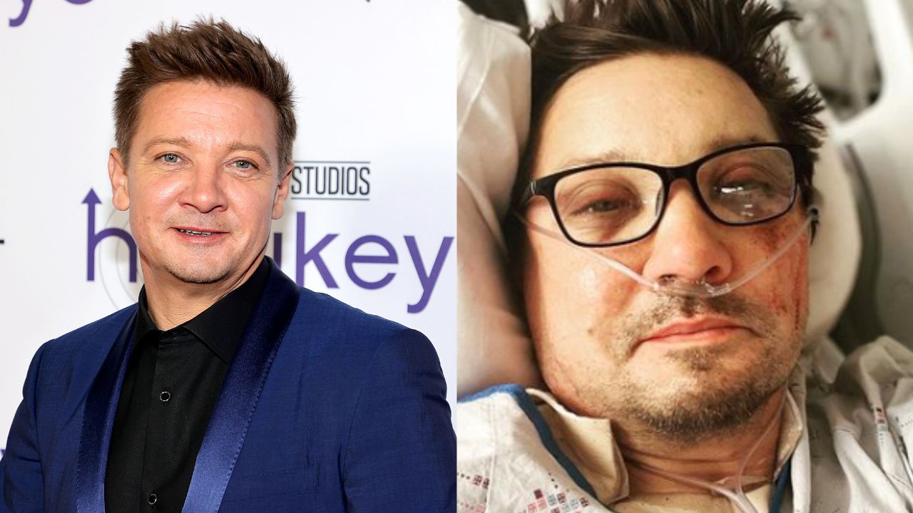 Com sistema inovador, ator Jeremy Renner se recupera de acidente