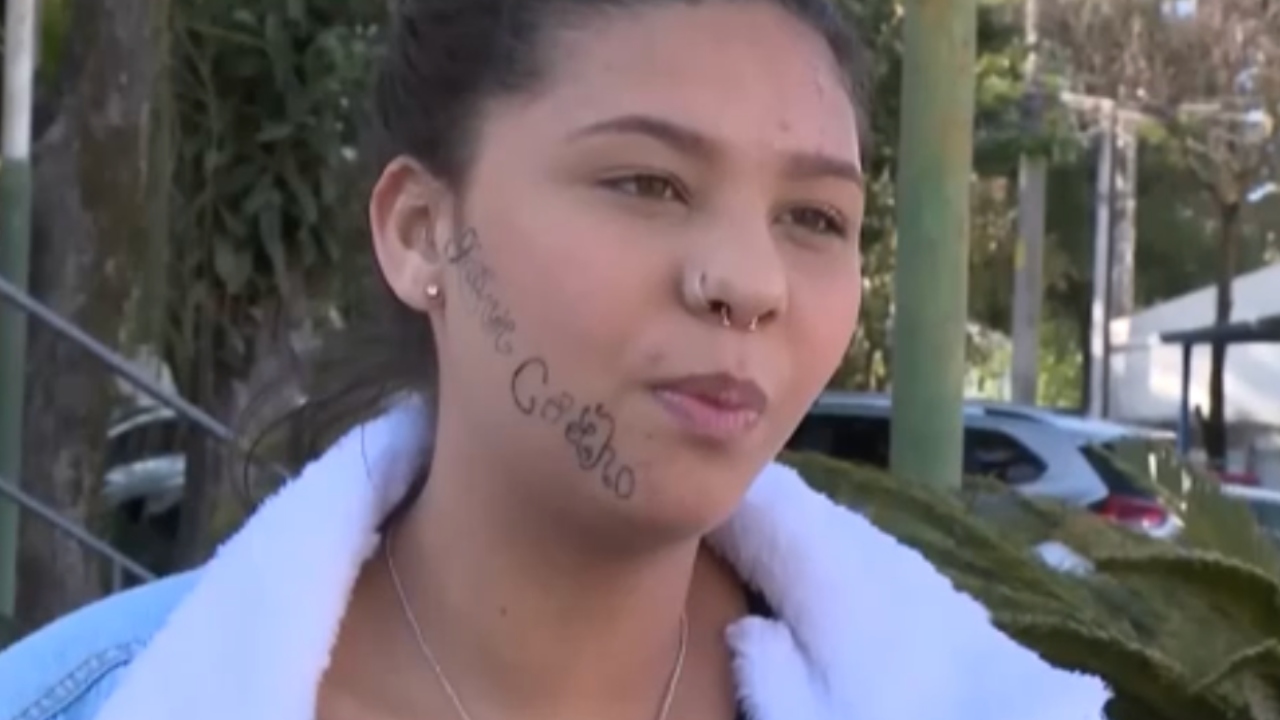 Rosto tatuado por ex-namorado: Jovem inicia sessões para remoção