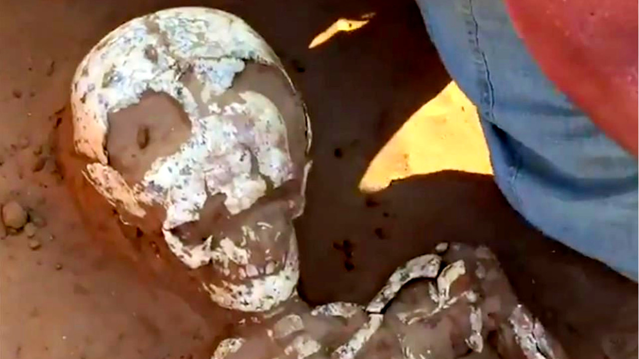 Arqueólogos encontram crânio de 2 mil anos com formato intrigante