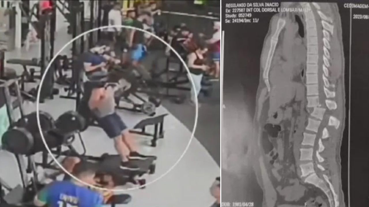 Homem que se acidentou em academia recorda episódio: ‘Senti o meu corpo partindo’